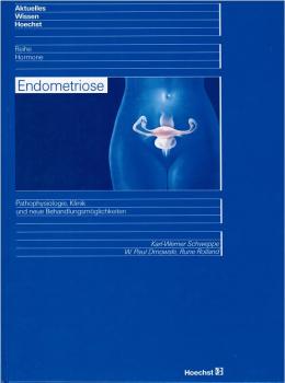Endometriose : [Pathophysiologie, Klinik und neue Behandlungsmöglichkeiten].
